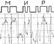 MIR signalas