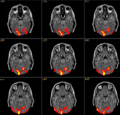 fMRI slide