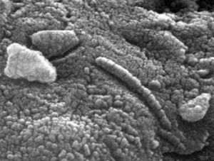 Nanobacteria