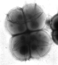 Deinococcus radiodurans
