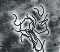 Methanothermobacter wolfeii