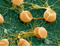 Pyrococcus furiosus